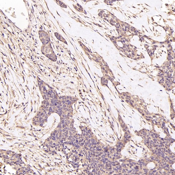 m00035 2 ihc9
