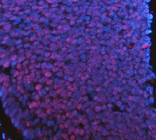 m00036 1 stat1 primary antibodies if testing 11