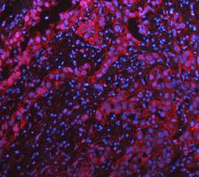 m00036 1 stat1 primary antibodies if testing 13