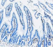 m00036 1 stat1 primary antibodies ihc testing 7