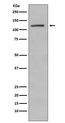 Western blot analysis of Retinoblastoma  phosphorylation expression in Jurkat cell lysate treated with Alkaline Phosphatase