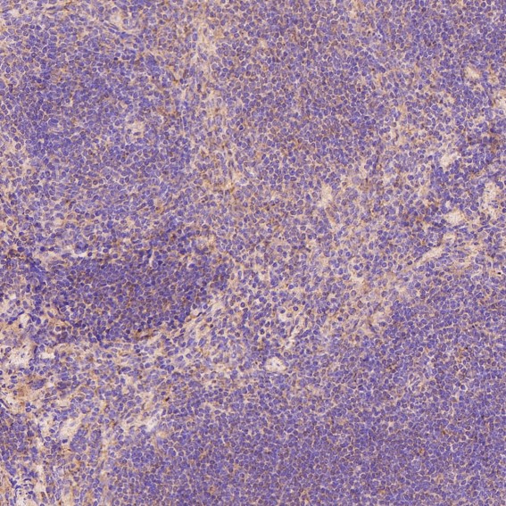 m00039 2 ihc11