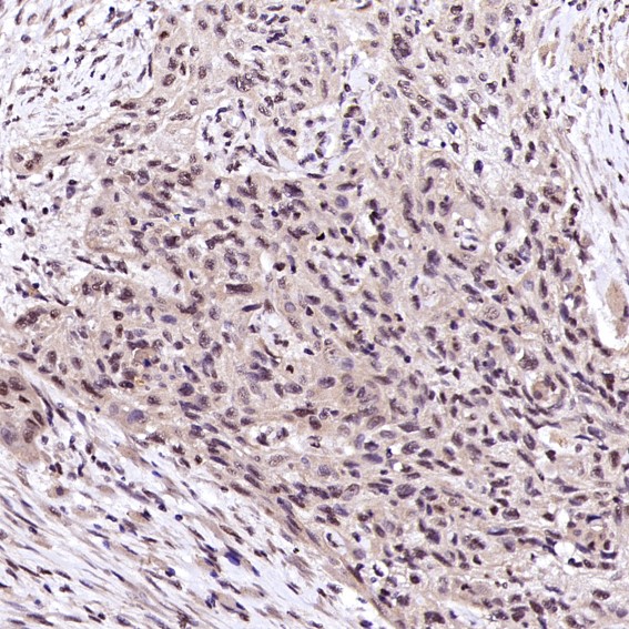m00039 2 ihc8