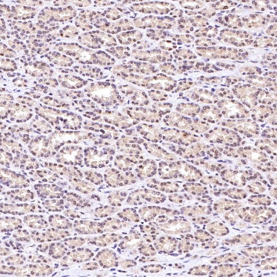 m00039 2 ihc9