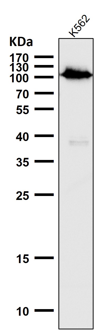 Western blot analysis of Phospho-Rb (S780) expression in K562 cell lysate