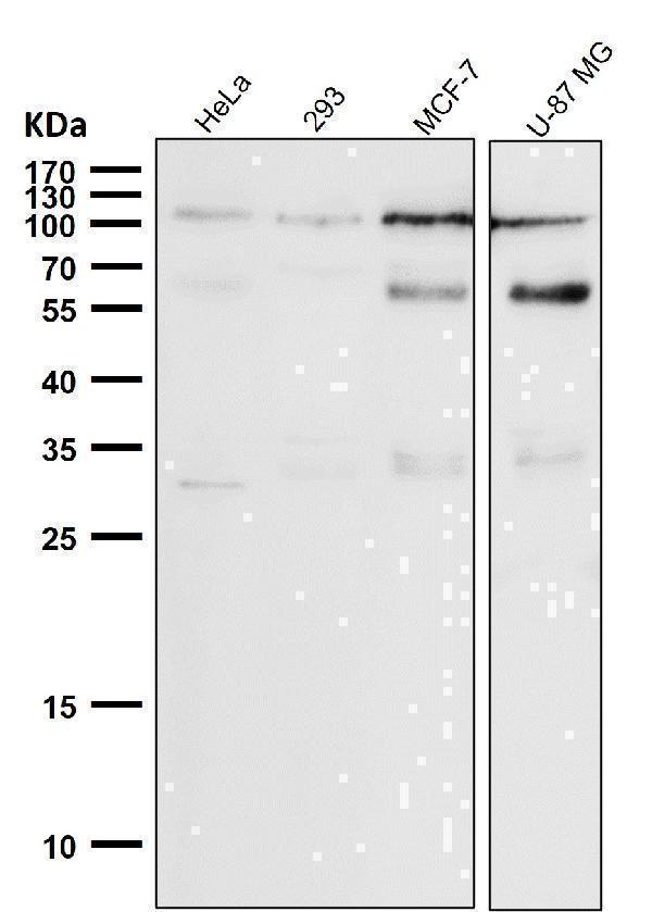 All lanes use the Antibody at 1:1K dilution for 1 hour at room temperature