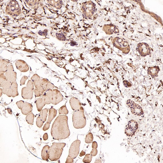 m00040 1 ihc11