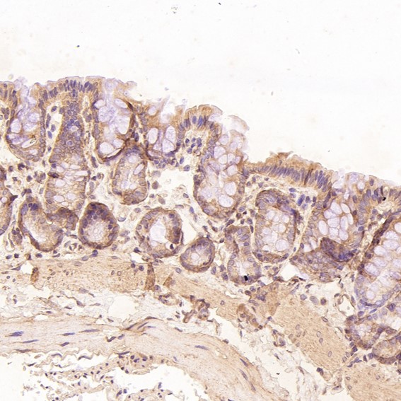 m00040 1 ihc8