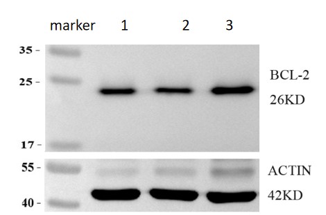 m00040 2 bcl 2 primary antibodies wb review 1
