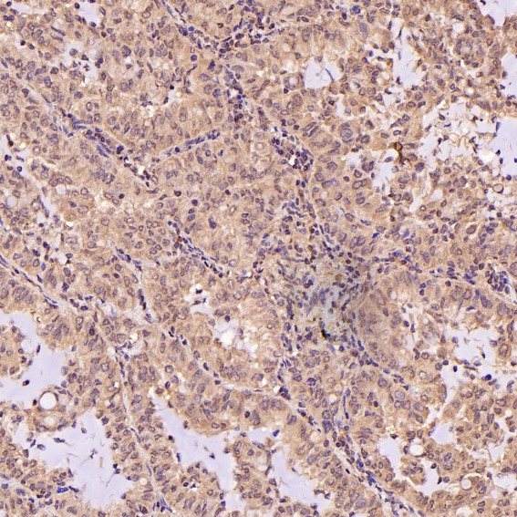 m00040 2 ihc7