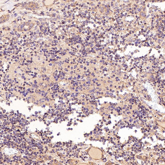 m00040 2 ihc8