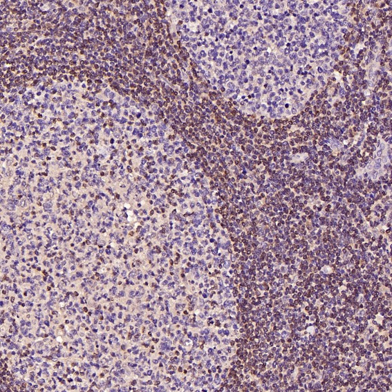 m00040 2 ihc9