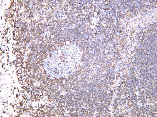 m00040 4 bcl2 primary antibodies ihc testing 1