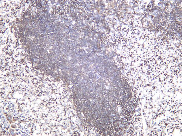 m00040 4 bcl2 primary antibodies ihc testing 2