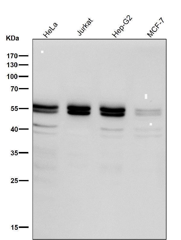 All lanes use the Antibody at 1:1K dilution for 1 hour at room temperature