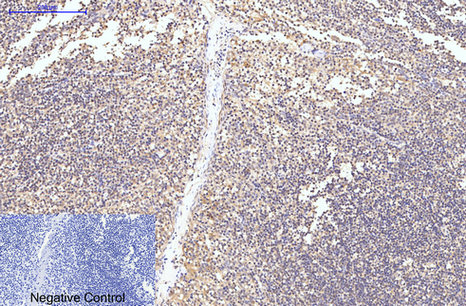 Immunohistochemical analysis of paraffin-embedded Human-Tonsil tissue