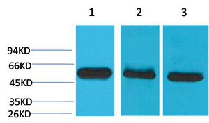 Western blot analysis of 1) Hela, 2) Mouse Brain Tissue, 3) Rat Brain Tissue using Caspase-8 Monoclonal Antibody