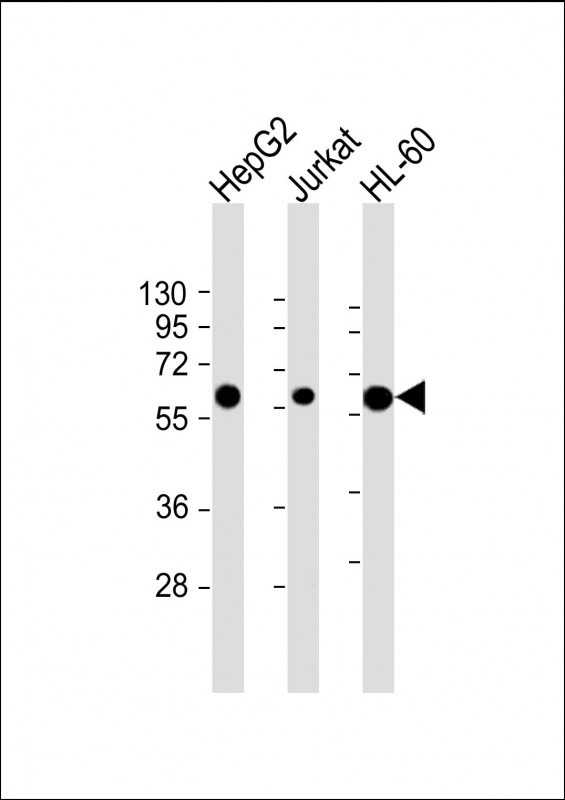 All lanes : Anti-CASP8 Antibody (C-term) at 1:2000 dilutionLane 1: HepG2 whole cell lysateLane 2: Jurkat whole cell lysateLane 3: HL-60 whole cell lysateLysates/proteins at 20 µg per lane