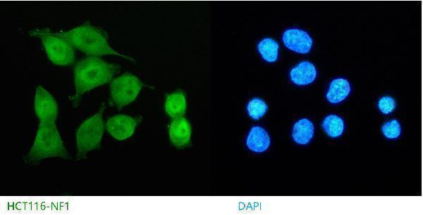 m00043 1 nf1 primary antibodies if testing 1