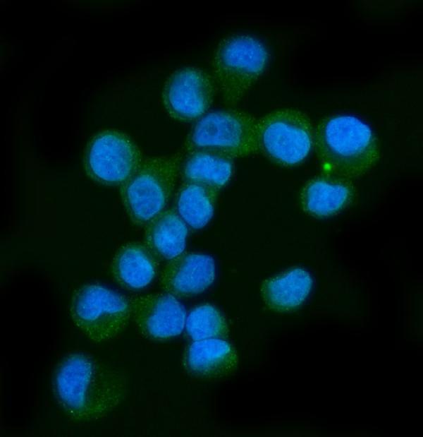 m00043 1 nf1 primary antibodies if testing 6