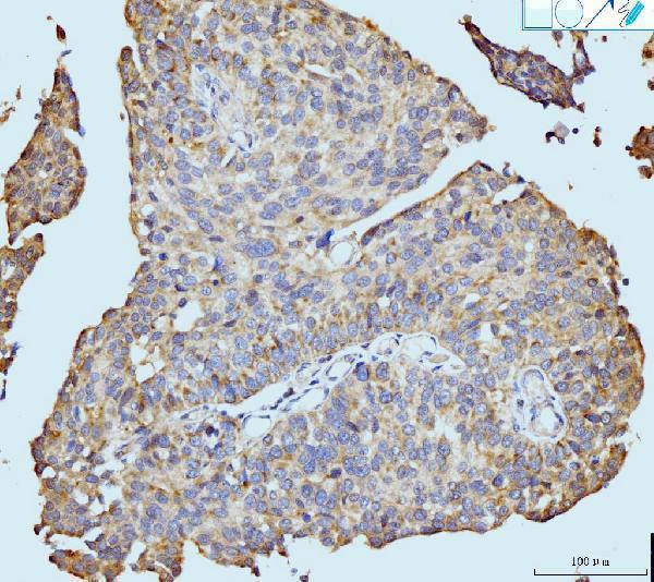 m00043 1 nf1 primary antibodies ihc testing 2