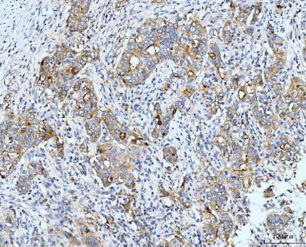 m00043 1 nf1 primary antibodies ihc testing 3