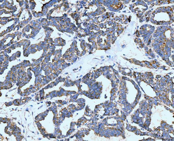 m00043 1 nf1 primary antibodies ihc testing 4