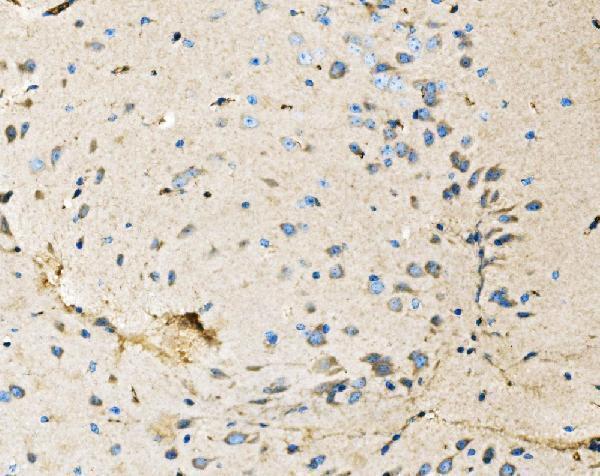 m00043 nf1 primary antibodies ihc testing 2