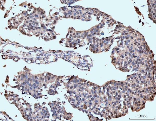 m00043 nf1 primary antibodies ihc testing 3