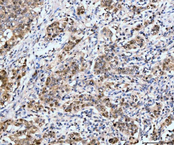 m00043 nf1 primary antibodies ihc testing 4