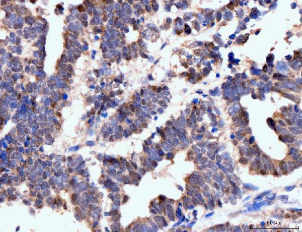 m00043 nf1 primary antibodies ihc testing 5