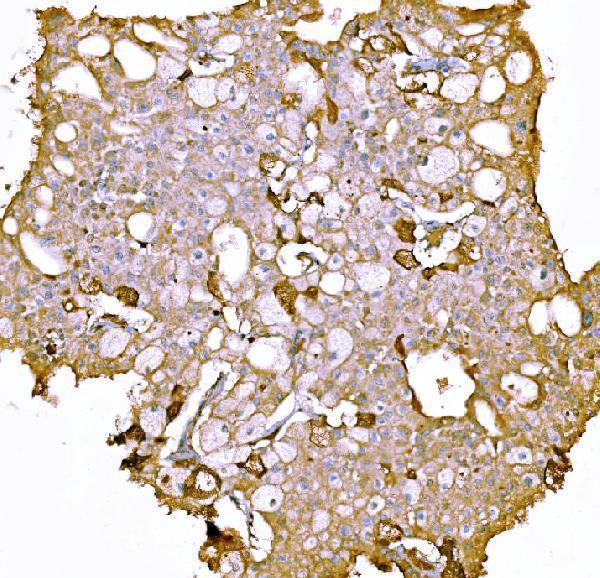  IHC analysis of Prothrombin using anti-Prothrombin antibody (M00044-2)