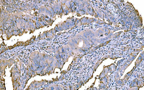  IHC analysis of Prothrombin using anti-Prothrombin antibody (M00044-2)