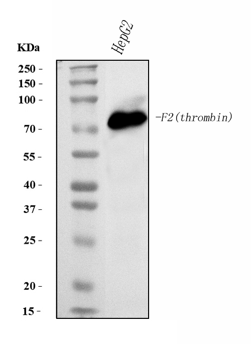  Western blot analysis of Prothrombin using anti-Prothrombin antibody (M00044-2)