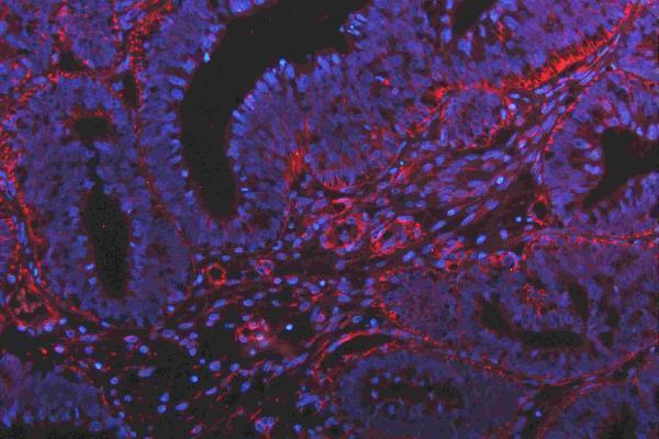 m00045 1 vegfa primary antibodies if testing 11