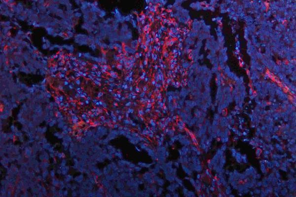 m00045 1 vegfa primary antibodies if testing 12