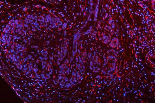m00045 1 vegfa primary antibodies if testing 13