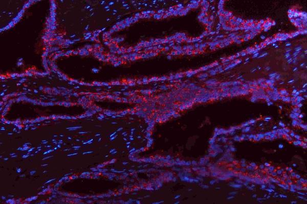 m00045 1 vegfa primary antibodies if testing 14