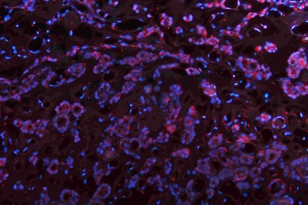 m00045 1 vegfa primary antibodies if testing 15