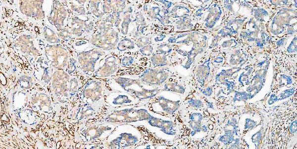 m00045 1 vegfa primary antibodies ihc testing 1