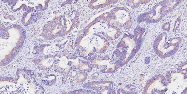 m00045 1 vegfa primary antibodies ihc testing 2