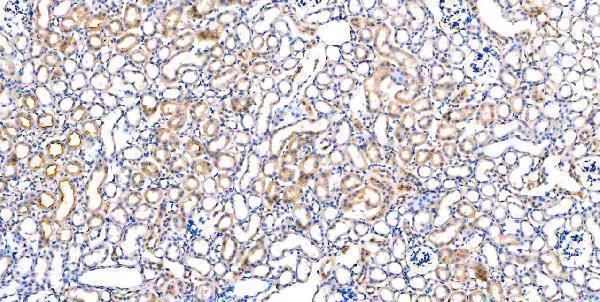 m00045 1 vegfa primary antibodies ihc testing 4