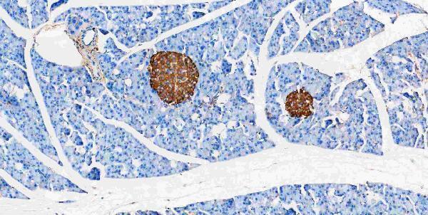 m00045 1 vegfa primary antibodies ihc testing 5