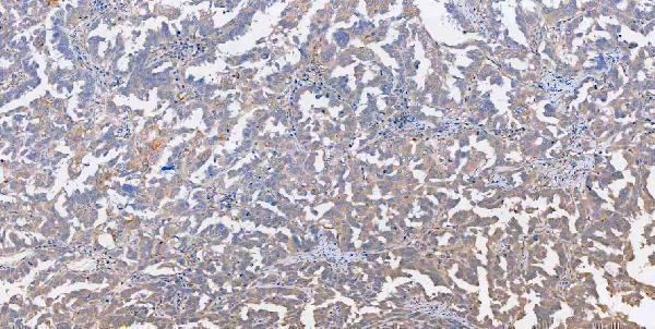 m00045 1 vegfa primary antibodies ihc testing 6