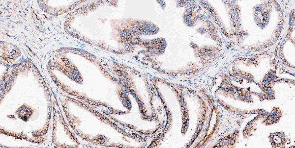 m00045 1 vegfa primary antibodies ihc testing 7