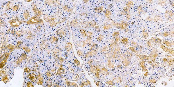 m00045 1 vegfa primary antibodies ihc testing 8