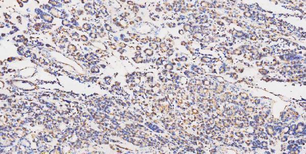 m00045 1 vegfa primary antibodies ihc testing 9