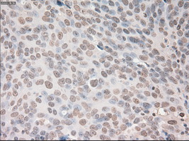 m00045 2 anti vegfa mouse monoclonal antibody clone id oti2f7 ihc testing 3