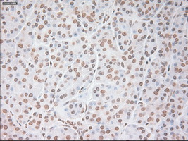 m00045 2 anti vegfa mouse monoclonal antibody clone id oti2f7 ihc testing 4