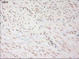 m00045 2 anti vegfa mouse monoclonal antibody clone id oti2f7 ihc testing 6